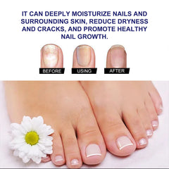 Nail Care Solution for Repairing Hands & Feet – Strengthens Nails, Thickens, Shines, Moisturizes & Cleanses