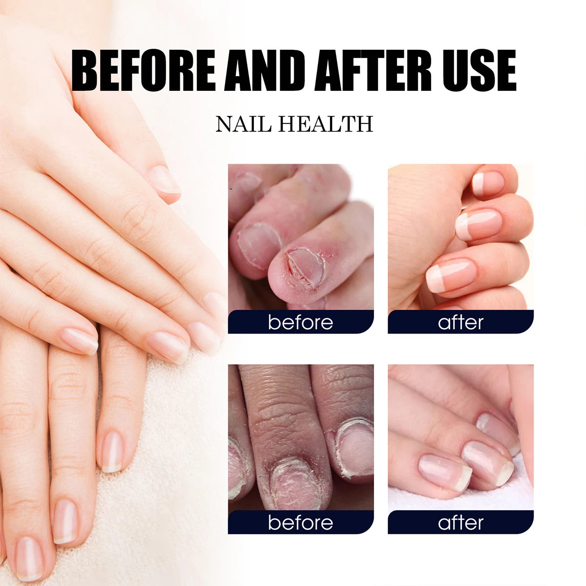 Nail Care Solution for Repairing Hands & Feet – Strengthens Nails, Thickens, Shines, Moisturizes & Cleanses