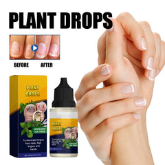 Nail Care Solution for Repairing Hands & Feet – Strengthens Nails, Thickens, Shines, Moisturizes & Cleanses